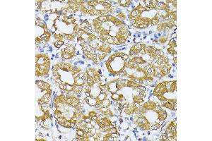 Immunohistochemistry (IHC) image for anti-Parkinson Protein 2, E3 Ubiquitin Protein Ligase (Parkin) (PARK2) (AA 1-300) antibody (ABIN3021179)