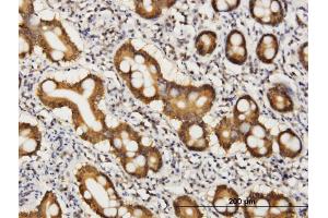 Immunoperoxidase of monoclonal antibody to COASY on formalin-fixed paraffin-embedded human small Intestine. (COASY antibody  (AA 461-564))