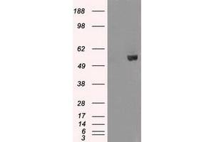 Image no. 2 for anti-V-Akt Murine Thymoma Viral Oncogene Homolog 2 (AKT2) antibody (ABIN1496565) (AKT2 antibody)