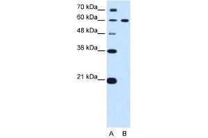 DTX2 antibody used at 0. (DTX2 antibody)