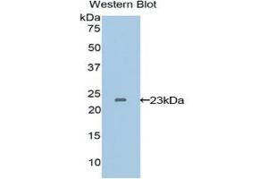 Western blot analysis of the recombinant protein. (VEGFB antibody  (AA 22-207))