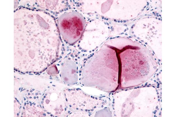 PDE8B antibody  (Internal Region)