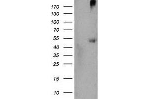 HEK293T cells were transfected with the pCMV6-ENTRY control (Left lane) or pCMV6-ENTRY SHPK (Right lane) cDNA for 48 hrs and lysed. (SHPK antibody)