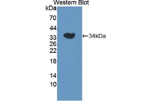 Western blot analysis of the recombinant protein. (ADRBK2 antibody  (AA 191-453))