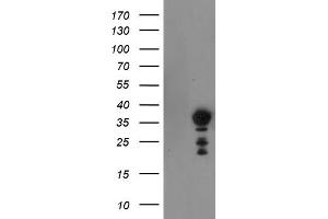 HEK293T cells were transfected with the pCMV6-ENTRY control (Left lane) or pCMV6-ENTRY NRIP3 (Right lane) cDNA for 48 hrs and lysed. (NRIP3 antibody)