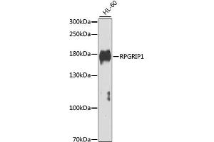 Western blot analysis of extracts of HL-60 cells, using RPGRIP1 antibody (ABIN4905033) at 1:1000 dilution. (RPGRIP1 antibody)
