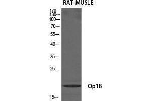 Western Blot (WB) analysis of specific cells using Op18 Polyclonal Antibody. (Stathmin 1 antibody  (Ser729))