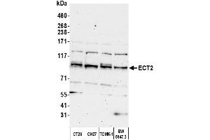 anti-Epithelial Cell Transforming Sequence 2 Oncogene (ECT2) (AA 833-883) antibody