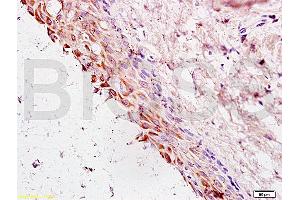 Formalin-fixed and paraffin embedded rat ovary tissue labeled with Anti-Cyclin G Polyclonal Antibody, Unconjugated (ABIN685837) at 1:200 followed by conjugation to the secondary antibody and DAB staining
