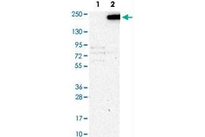 Western Blot analysis of Lane 1: negative control (vector only transfected HEK293T cell lysate) and Lane 2: over-expression lysate (co-expressed with a C-terminal myc-DDK tag in mammalian HEK293T cells) with KANK1 polyclonal antibody . (ANKRD15 antibody)