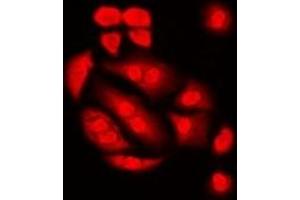Immunofluorescent analysis of Int11 staining in Hela cells. (CPSF3L antibody)