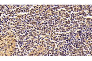 Detection of TLR2 in Porcine Spleen Tissue using Polyclonal Antibody to Toll Like Receptor 2 (TLR2) (TLR2 antibody  (AA 47-245))