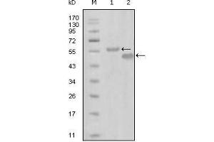 Western Blot showing EphA6 antibody used against truncated MBP-EphA6 recombinant protein (1) and truncated GST-EphA6 (aa695-795) recombinant protein (2). (EPH Receptor A6 antibody  (AA 695-795))