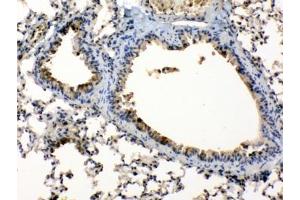 IHC testing of FFEP mouse lung tissue with Periplakin antibody at 1ug/ml. (PPL antibody  (AA 1664-1701))