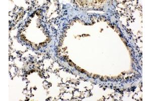 IHC testing of FFEP mouse lung tissue with Periplakin antibody at 1ug/ml.