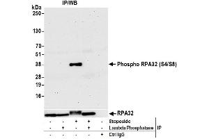 Immunoprecipitation (IP) image for anti-Replication Protein A2, 32kDa (RPA2) (pSer4), (pSer8) antibody (ABIN7455212) (RPA2 antibody  (pSer4, pSer8))