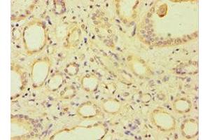Immunohistochemistry of paraffin-embedded human kidney tissue using ABIN7144692 at dilution of 1:100