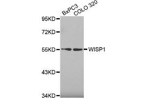 Western blot analysis of extracts of various cell lines, using WISP1 antibody. (WISP1 antibody  (AA 158-367))