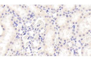 Detection of SOX18 in Rat Kidney Tissue using Polyclonal Antibody to Sex Determining Region Y Box Protein 18 (SOX18) (SOX18 antibody  (AA 153-377))