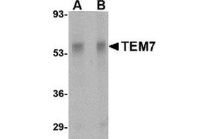 Western blot analysis of TEM7 in rat liver tissue lysate with this product at (A) 0.