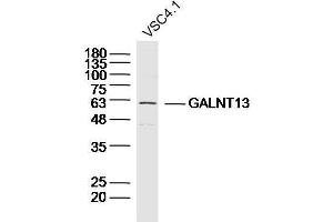 VSC4. (GALNT13 antibody  (AA 351-450))
