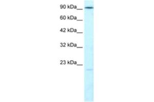 Western Blotting (WB) image for anti-Ligase IV, DNA, ATP-Dependent (LIG4) antibody (ABIN2460869) (LIG4 antibody)