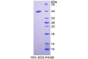 SDS-PAGE (SDS) image for Nischarin (NISCH) (AA 1246-1346) protein (His tag,GST tag) (ABIN1980700)