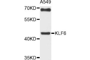 Western blot analysis of extracts of A549 cells, using KLF6 antibody. (KLF6 antibody)