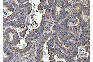 IHC analysis of ATP5F1B using anti-ATP5F1B antibody (ABIN7599866). (Atp5f1b (AA 123-529) antibody)