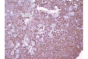 IHC analysis of PBP using anti-PBP antibody (ABIN5693043).