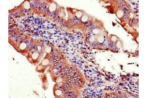 Immunohistochemistry of paraffin-embedded human small intestine tissue using ABIN7152149 at dilution of 1:100 (EIF3C antibody  (AA 201-500))