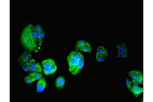 Immunofluorescent analysis of MCF-7 cells using ABIN7163072 at dilution of 1:100 and Alexa Fluor 488-congugated AffiniPure Goat Anti-Rabbit IgG(H+L) (Phenylalanyl-tRNA Synthetase, alpha Subunit (FARSA) (AA 2-508) antibody)