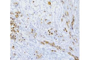 IHC analysis of SQSTM1 using anti-SQSTM1 antibody (ABIN3043937). (SQSTM1 antibody  (N-Term))