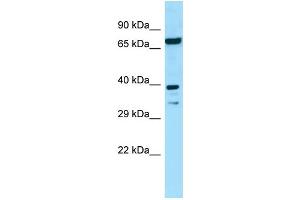 WB Suggested Anti-EIF2B2 Antibody Titration: 1. (EIF2B2 antibody  (N-Term))