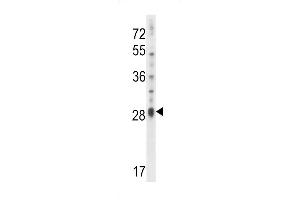 Western blot analysis in NCI-H460 cell line lysates (35ug/lane). (IL17D antibody  (C-Term))