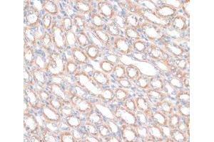 Immunohistochemistry of paraffin-embedded Mouse kidney using PDGFD Polyclonal Antibody at dilution of 1:100 (40x lens). (PDGFD antibody)