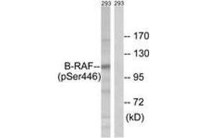 Western blot analysis of extracts from 293 cells treated with EGF 200ng/ml 30', using B-RAF (Phospho-Ser446) Antibody. (SNRPE antibody  (pSer446))