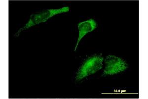 Immunofluorescence of monoclonal antibody to ARL8A on HeLa cell. (ARL8A antibody  (AA 1-186))