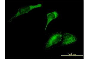 Immunofluorescence of monoclonal antibody to ARL8A on HeLa cell.