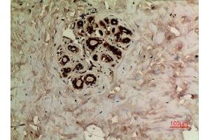 Immunohistochemistry (IHC) image for anti-alpha Tubulin (TUBA1) (acLys40) antibody (ABIN3181895)