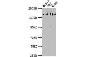 Western Blot Positive WB detected in: MCF-7 whole cell lysate, U87 whole cell lysate, K562 whole cell lysate All lanes: TJP2 antibody at 1:2000 Secondary Goat polyclonal to rabbit IgG at 1/50000 dilution Predicted band size: 134, 118, 112, 132, 116, 131, 138 kDa Observed band size: 150 kDa (TJP2 antibody  (AA 1165-1183))