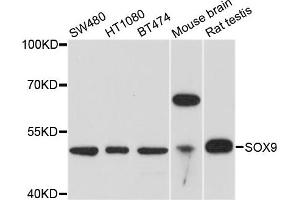 Western blot analysis of extracts of various cell lines, using SOX9 antibody. (SOX9 antibody)