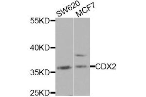 Western blot analysis of extracts of various cell lines, using CDX2 antibody. (CDX2 antibody)