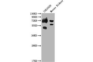 Western Blot Positive WB detected in: COLO320 whole cell lysate, Mouse Kidney tissue All lanes: SLC39A4 antibody at 1:2000 Secondary Goat polyclonal to rabbit IgG at 1/50000 dilution Predicted band size: 69, 67 kDa Observed band size: 69 kDa (SLC39A4 antibody  (AA 26-266))