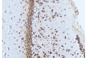 ABIN6277247 at 1/100 staining Mouse brain tissue by IHC-P.