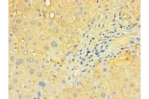 Immunohistochemistry of paraffin-embedded human liver tissue using ABIN7170195 at dilution of 1:100 (SLC25A4 antibody  (AA 40-102))