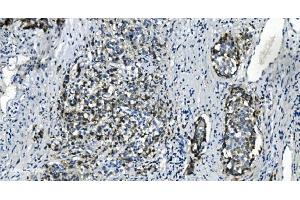 IHC analysis of TMBIM1 using anti-TMBIM1 antibody (ABIN7603190). (TMBIM1 antibody  (N-Term))