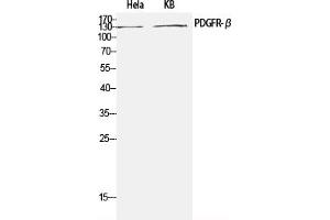 Western Blotting (WB) image for anti-Platelet Derived Growth Factor Receptor beta (PDGFRB) (Tyr751) antibody (ABIN5960495) (PDGFRB antibody  (Tyr751))