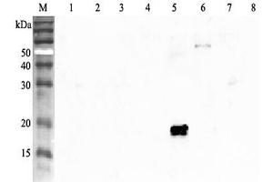 Western blot analysis using anti-ANGPTL4 (human), pAb  at 1:2'000 dilution.