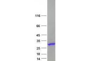 ZBTB8OS Protein (Myc-DYKDDDDK Tag)